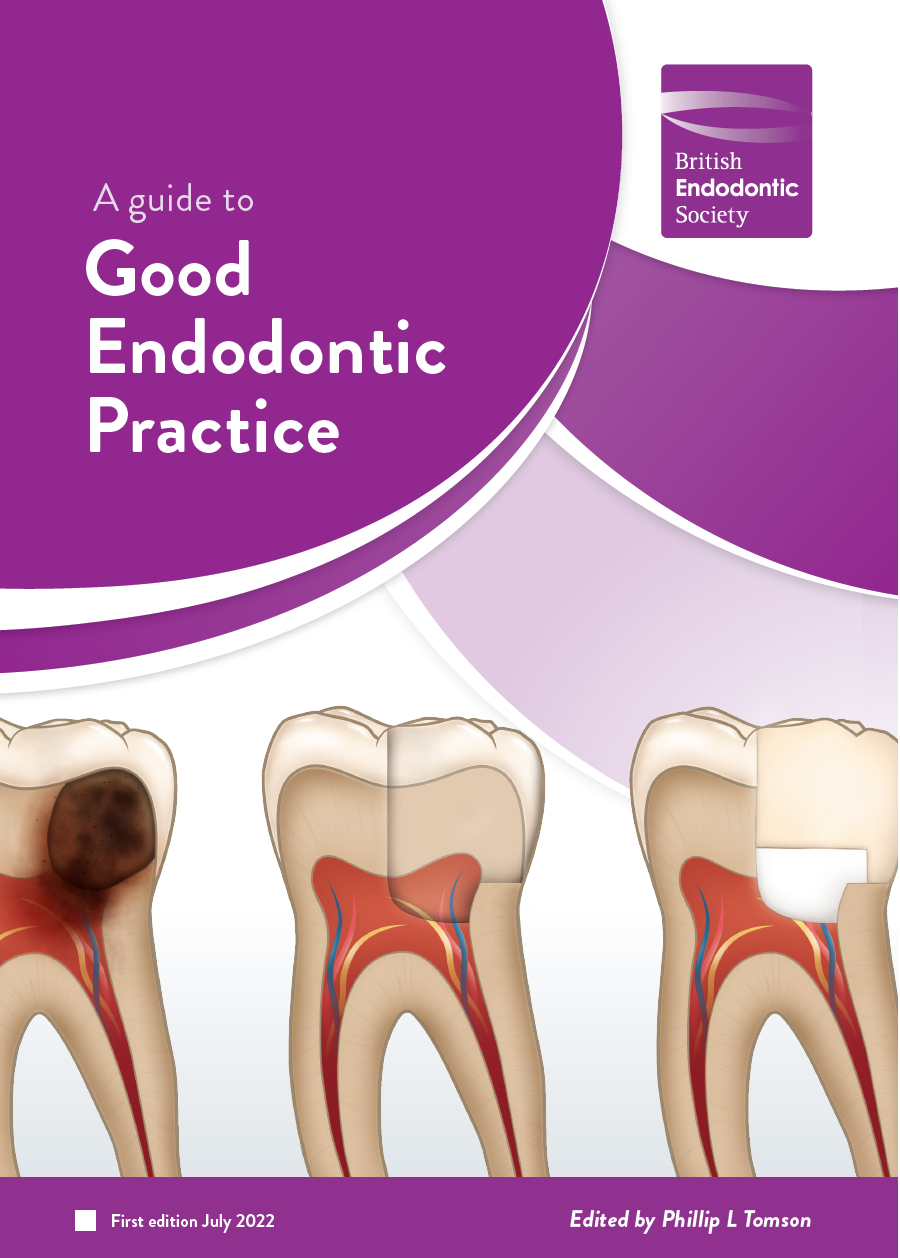 A Guide to Good Endodontic Practice British Endodontic Society