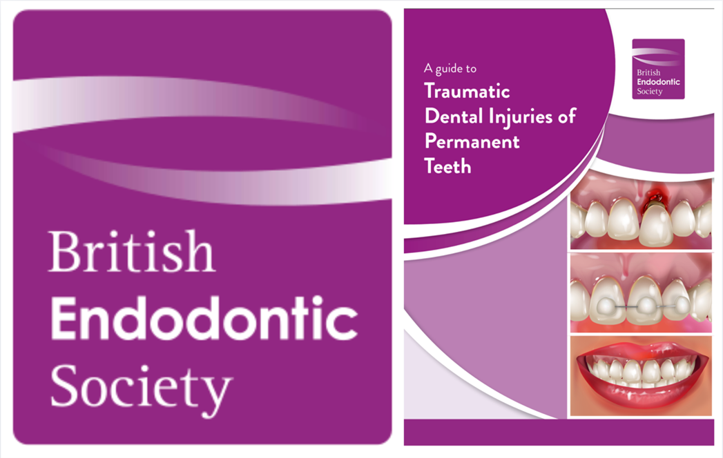 Guide to Good Endodontic Practice and the NEW Trauma Guide